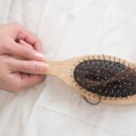 Τριχόπτωση